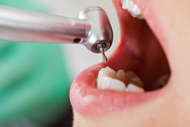Best Knocked-Out Tooth Emergency  in Harbison Nyon, CA